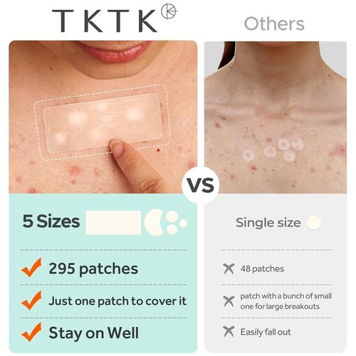 TKTK Large Pimple Patches for Face, 68 x 27 mm XL Hydrocolloid Bandages, Big Acne Patches for Body, Forehead, Chin, Nose, Chest and Back Blemish Zit Breakouts (Strip, Contoured, Dot 5 Sizes 136 Count)