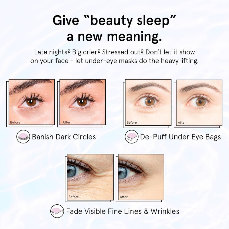 grace & stella Retinol Under Eye Patches for Puffy Eyes and Dark Circles - Restoring Gel Under Eye Masks with Hyaluronic Acid - Vegan Skincare, Self Care Gifts for Women (Purple, 48 Pairs)