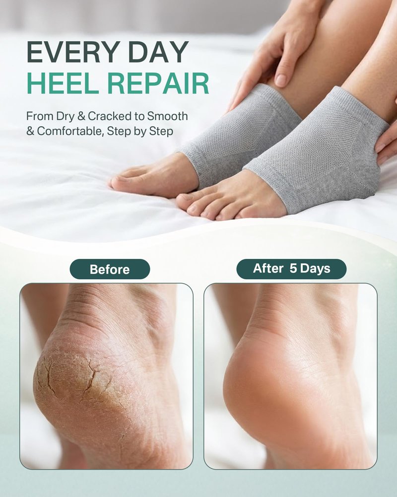 4 Socks Moisturizing Socks for Women, Silicone Socks & Gel Socks, Heel Socks for Dry Cracked Feet, Heel Protectors for Cracked Heel Treatment, Foot Care Socks, Toeless Socks for Women and Men, Gray