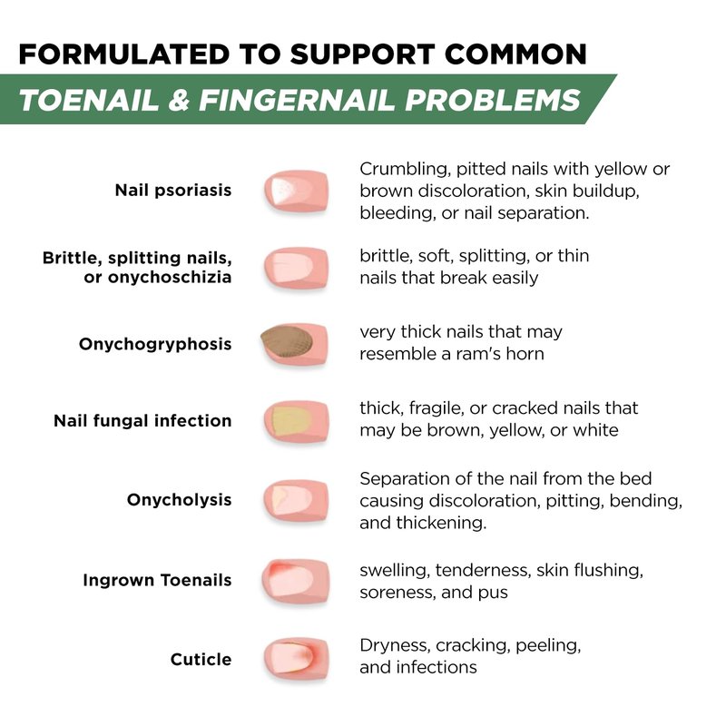Foot Cure Toenail Fungus Treatment Extra Strength – Athletes Foot Treatment for Toenails, Restorative Nail Repair for Damaged Nails, Toenail Softener with Tea Tree Oil & Oregano Oil - Made in USA