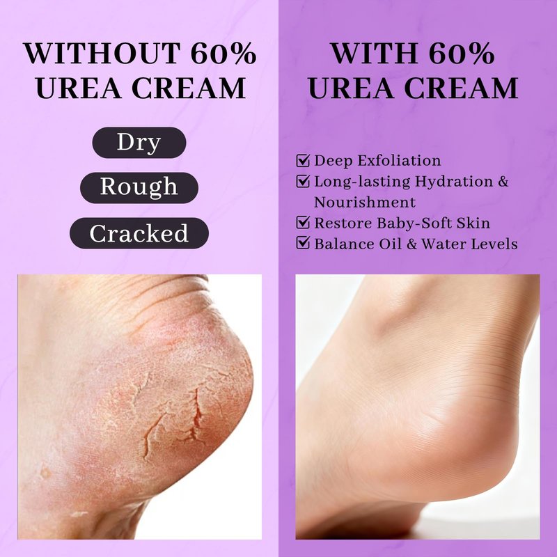 Clyecfra 5-in-1 60% Urea Cream with 2% Salicylic Acid, Urea Cream 60 Percent for Feet & Hands- Maximum Strength Moisturizer for Rough, Dry, Thick & Cracked Skin, Callus Remover, Deep Hydration, 150g