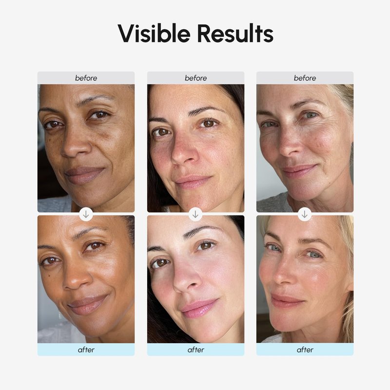 MAREE Retinol Face Moisturizer - Anti-Aging Cream with Collagen for Daily Use - Hydrating Facial Cream