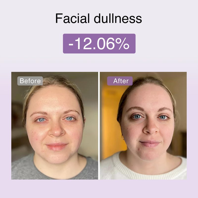 DermRays Multi-RF Microcurrent Device with 650nm Red Light, 4-in-1 Facial Toning Tool with Multi-Leading Tech for a Visibly Radiant & Youthful Appearance