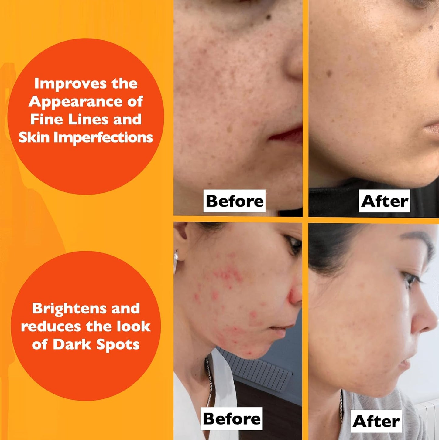 Vitamin C Serum for Face - Anti-Aging Brightening Formula with Hyaluronic Acid & Vitamin E | 2 Fl Oz