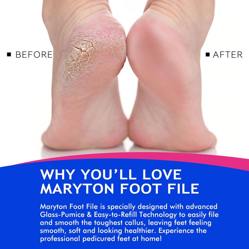 Maryton Professional Foot File - Foot Callus Remover, Foot Scrubber, Dead Skin Remover, Pedicure Tools for Feet, Glass Pumice Stone Foot Buffer