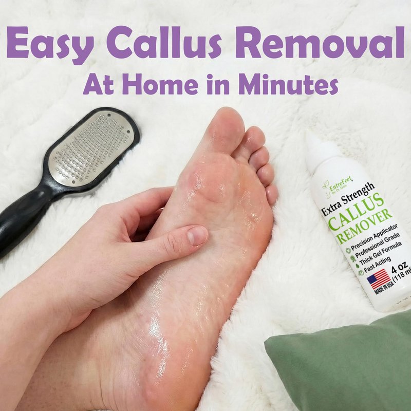 Dr. Entre's Callus Remover Gel & Foot File: Extra Strength Callus Remover for Feet, Foot Callus Remover Care, Pedicure Tools Supplies, Spa Kit, Dead Skin Scrubber, 4 oz