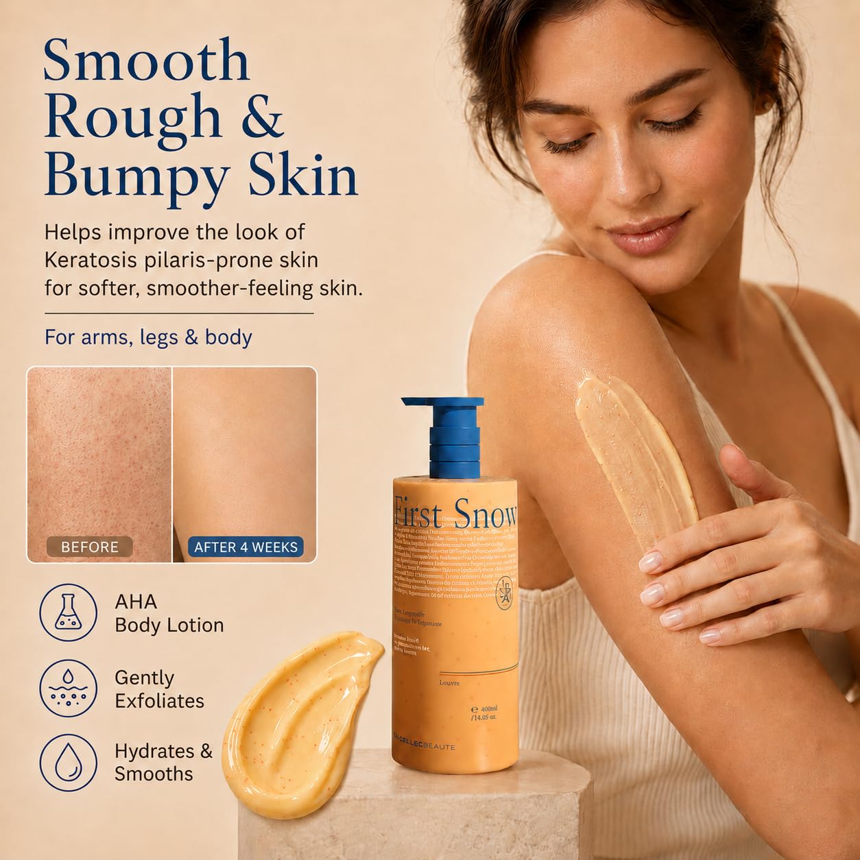 Advanced AHA Body Lotion 6% Glycolic Acid Treats Back Acne, Keratosis Pilaris & Dryness - With Glycolic, Lactic, Citric Acids - Exfoliating Moisturizer with Long Lasting Perfumed Experience,14 Oz
