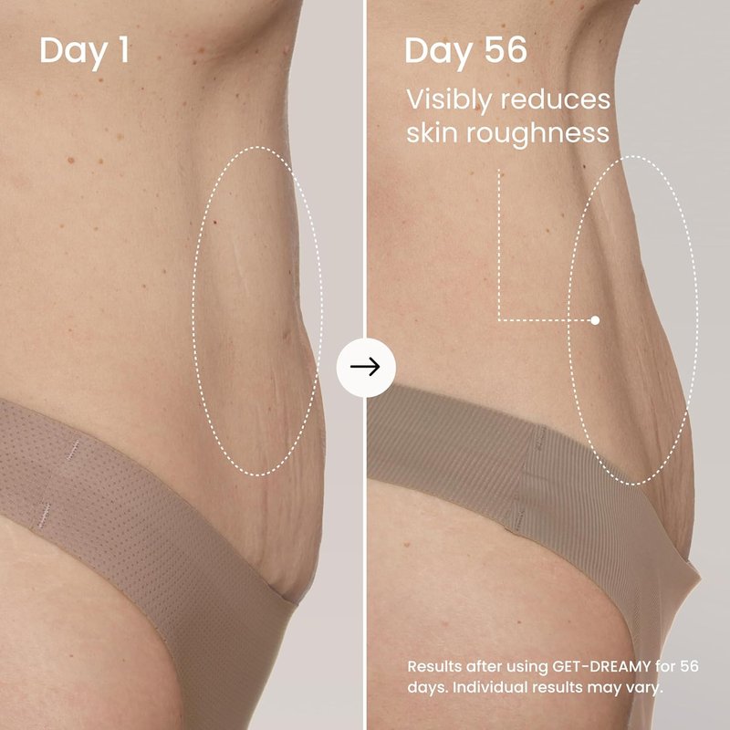Get-Dreamy + B-TIGHT Bundle | Overnight Toning Whip & Firming Booty Mask - Skin Tightening Creams for Women