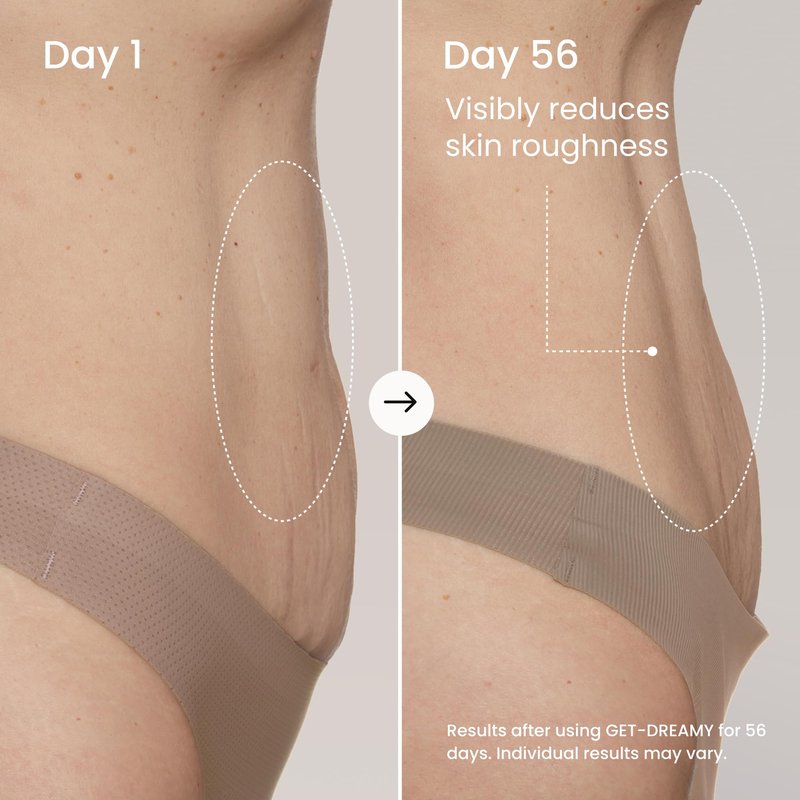 MAËLYS GET-DREAMY Overnight Toning Whip - Cellulite Cream & Skin Tightening Support with Milk Thistle + Uva-Ursi - Moisturizing Body Cream in a Whipped Texture (2 Pack)