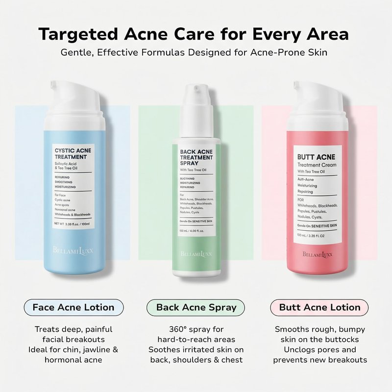 BellamiLuxx Butt Acne Clearing Treatment Cream: Body Acne Treatment for Folliculitis and Pimples on Buttocks, Thighs, and Body with 2% Salicylic Acid & Tea Tree Oil - Butt Cream for Smooth Skin