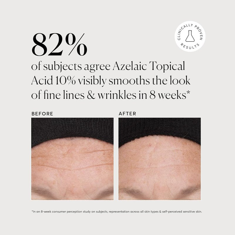 Naturium Azelaic Acid 10% Treatment | Face & Skin Care with Niacinamide & Vitamin C - 1 oz