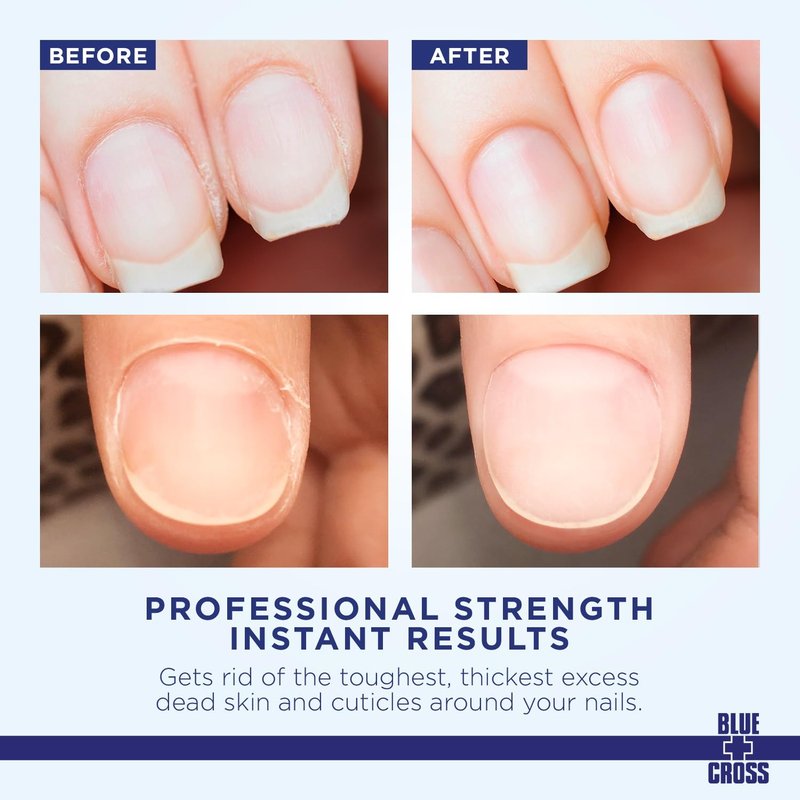 Cuticle Remover & Softener Liquid for Nails – Blue Cross Professional Nail Care with Lanolin, Hydrating Treatment for Dry Cuticles & Hangnails, Made in USA, 6oz