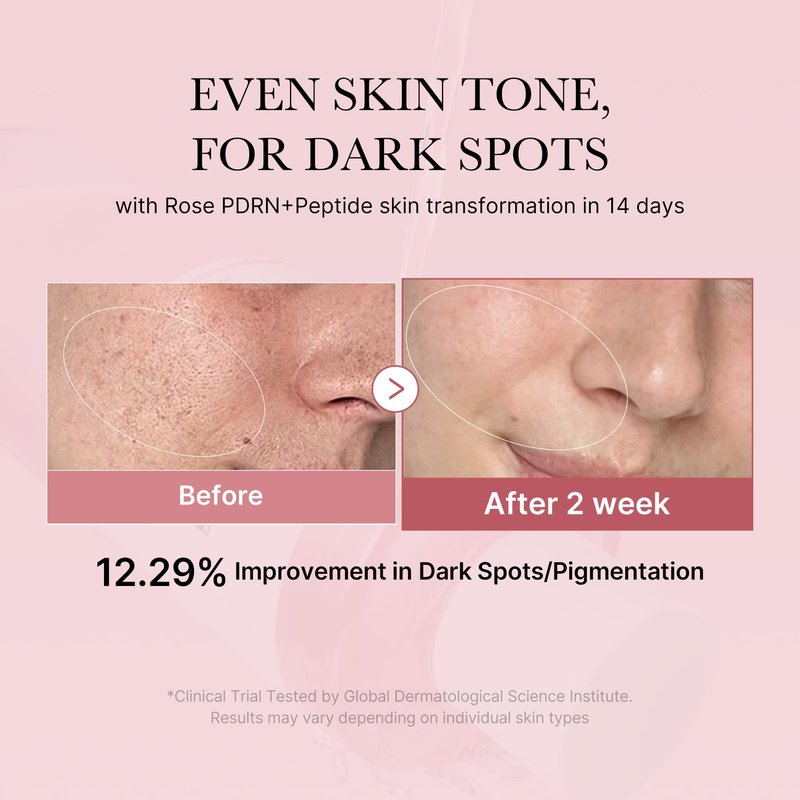 medicube PDRN Toner Rose PDRN Peptide Toner | Lightweight & Watery Type for Skin Boosting, Soothing and Calming, Uneven Skin Tone | with Rose, Peptide, Niacinamide | Korean Skincare, 8.45 fl.oz
