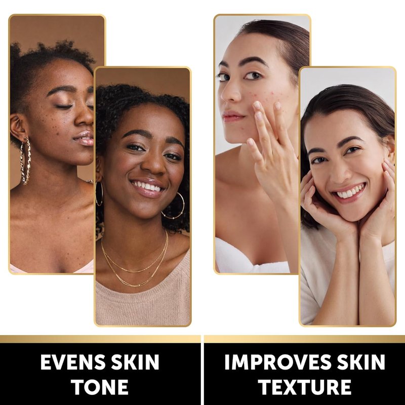 Brightening Lemon & Turmeric Kojic Acid Soap - Vitamin C, Retinol & Collagen | Dark Spot Corrector - 3 Pack with African Net