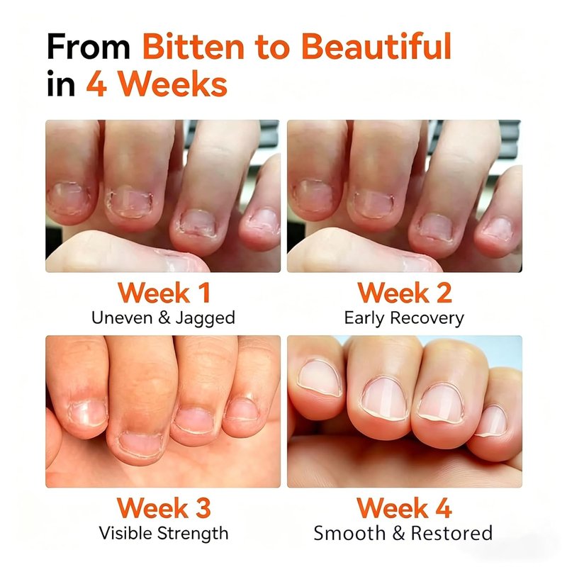 Modelones Nail Biting Prevention | Quick-Dry Bitter Nail Polish for Kids - 12ml (0.41 Fl Oz)