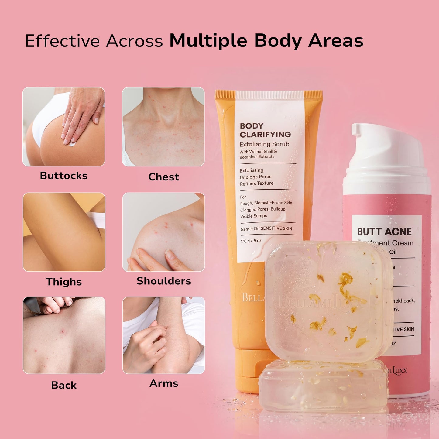 BellamiLuxx Butt Acne Treatment Set: Acne Soap Bar + Butt Treatment Lotion for Breakouts on Buttocks, Thighs, Back, Chest & Ingrown-Prone & Folliculitis-Prone Skin – Helps Reduce Body Breakouts