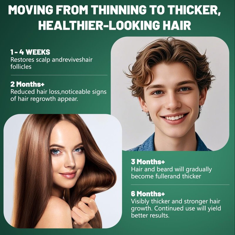 5% Minoxidil for Men - Minoxidil for Women Hair Growth Treatment Beard Growth Serum,Biotin & Rosemary to Fight Hair Loss, Strengthens Weak Roots, Repairs Thinning Hair