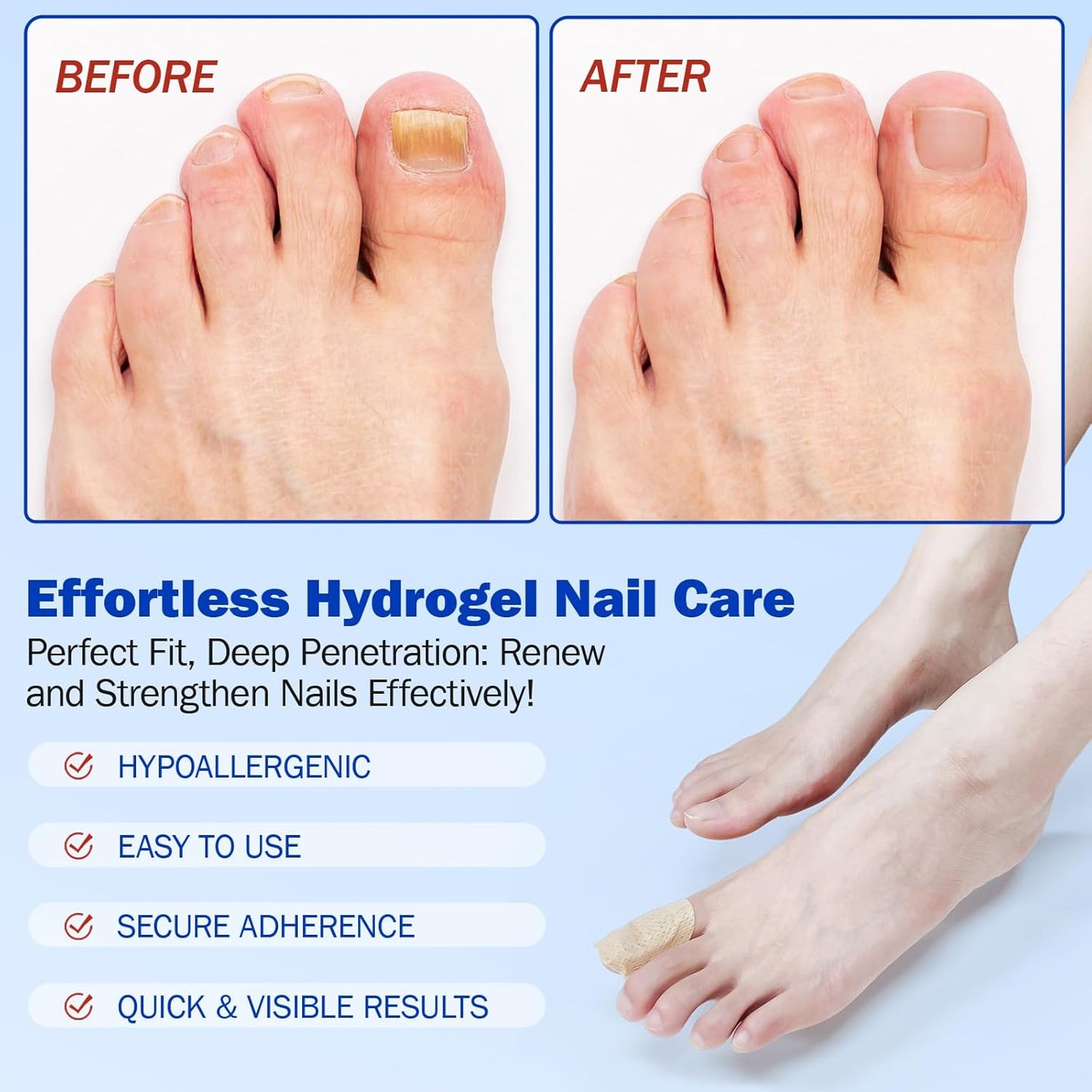 Skiennix Nail Patches for Toenail Repair - 42PCS Overnight Support for Damaged, Thick Toenails | Natural Formula