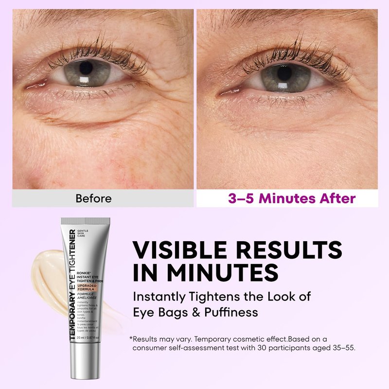 RONKIE Instant Firm Eye Tightener: Upgraded Formula for Women Helps Reduce Eye Bags Puffiness and Wrinkles in 3-5 Minutes When Time Matters 0.67 oz