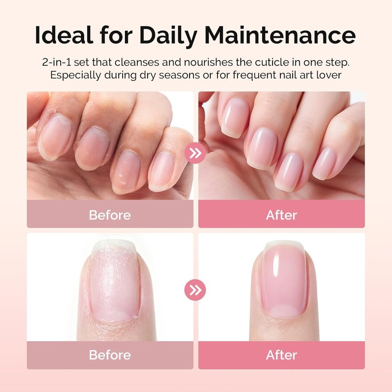 MelodySusie Cuticle Remover Kit - 60g Cream, 15ml Oil, Trimmer & Nail File for Perfect Manicure