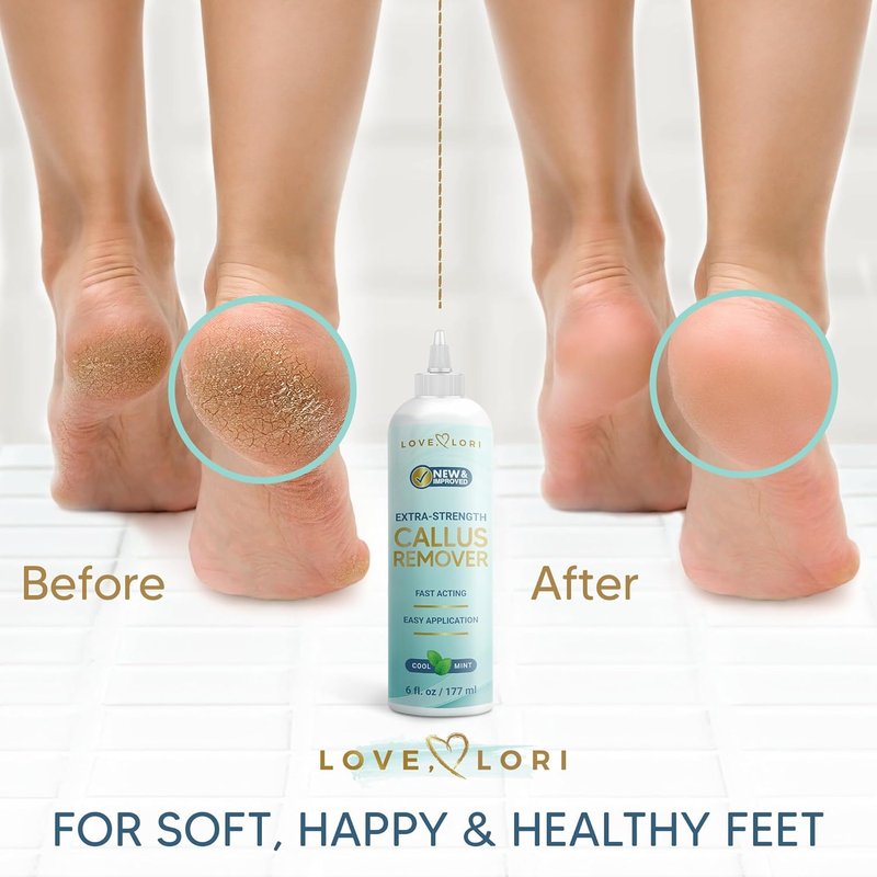 Callus Remover Gel - Extra Strength Foot Care Scrubber for Smooth Feet | 6oz Pedicure Tool