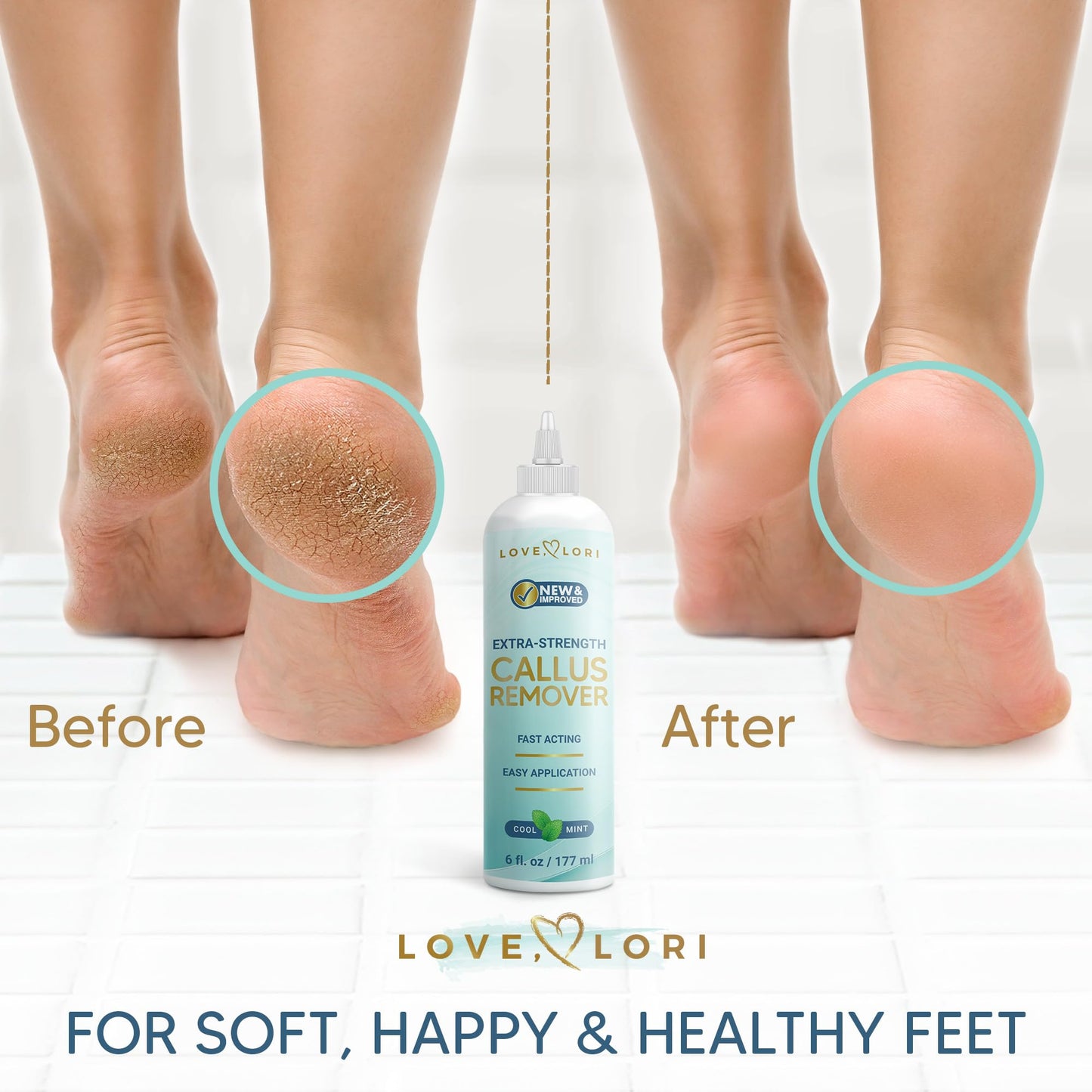 Callus Remover for Feet (Extra Strength) Foot Callus Remover Gel - Pedicure Tools for Feet Scrubber – Foot Care Spa Essentials, 6oz