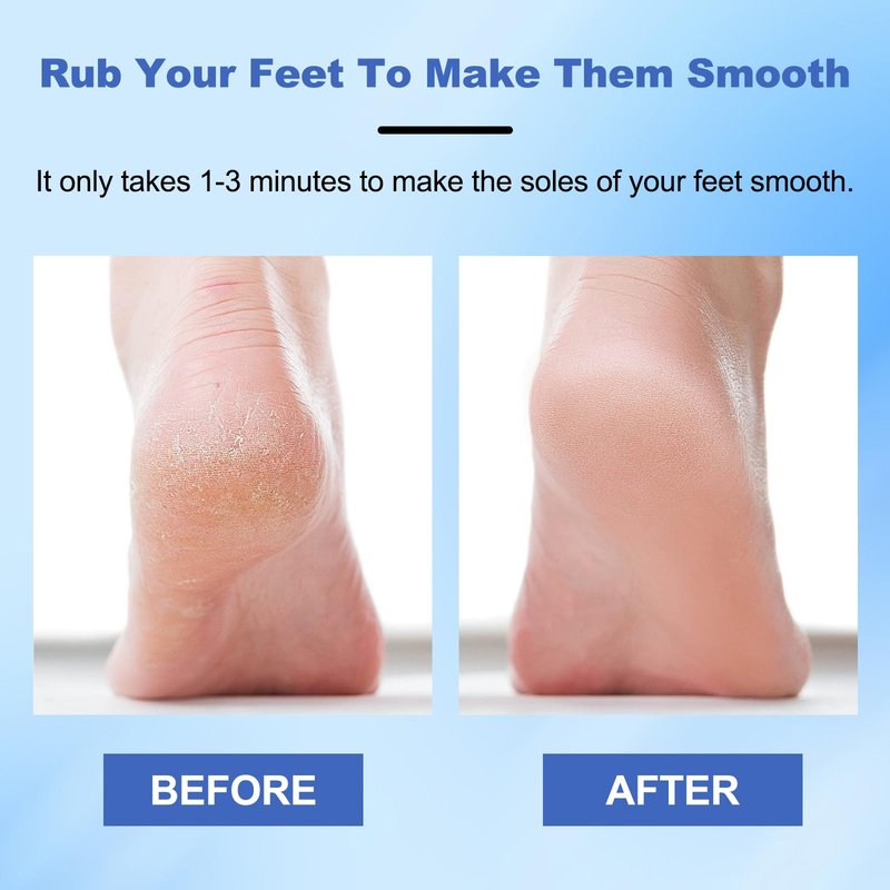 2pcs Hard Skin Remover Nano-Glass Foot File, Nano Glass Foot File with Non-Slip Ergonomic Handle, Professional Foot Care Tools (Gold+Blue)