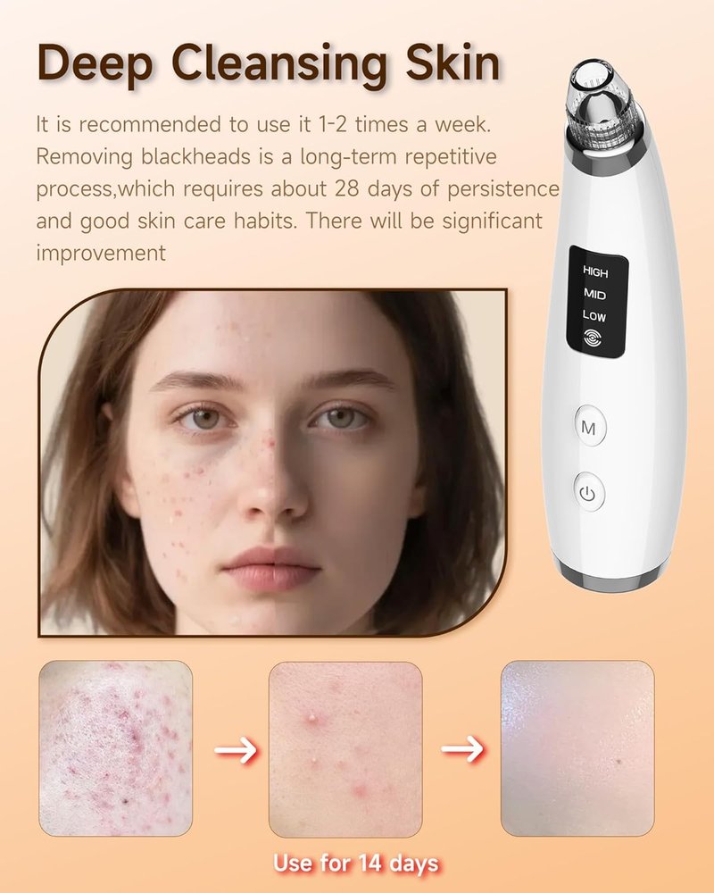 Blackhead Remover Vacuum - Type-C Rechargeable Pore Cleaner with 3 Suction Levels & 6 Probes | Face & Nose Comedone Extractor Tool (White)