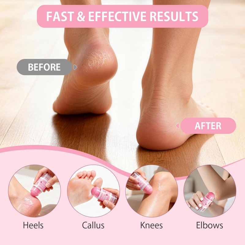Silicone Moisturizing Socks with Foot Cream- 2 in 1 Gel Socks & Foot Cream for Dry Feet, Foot Care Moisturizing Socks for Dry Cracked Feet Women