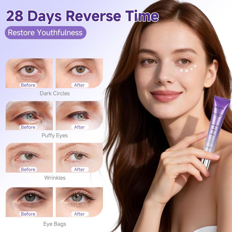 MEXYA Retinol & Caffeine Under Eye Cream for Dark Circles and Puffiness, Niacinamide Eye Brightener for Fine Lines, Under Eye Bags, Lightweight Fragrance-Free Formula, 0.7 oz