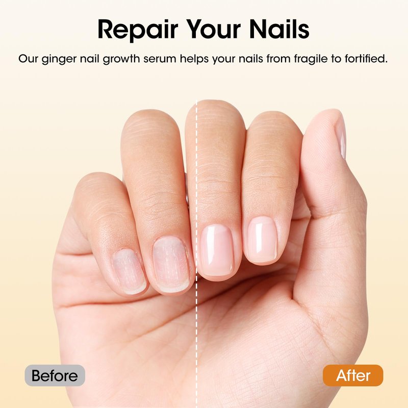 Gellen 7-14 Days Ginger Nail Growth Serum for Nail Strengthener and Growth, Nail Repair Treatment for Weak Brittle Splitting Damaged Nails, Hydrated & Nourished Nail Care Solution for Hands & Feet