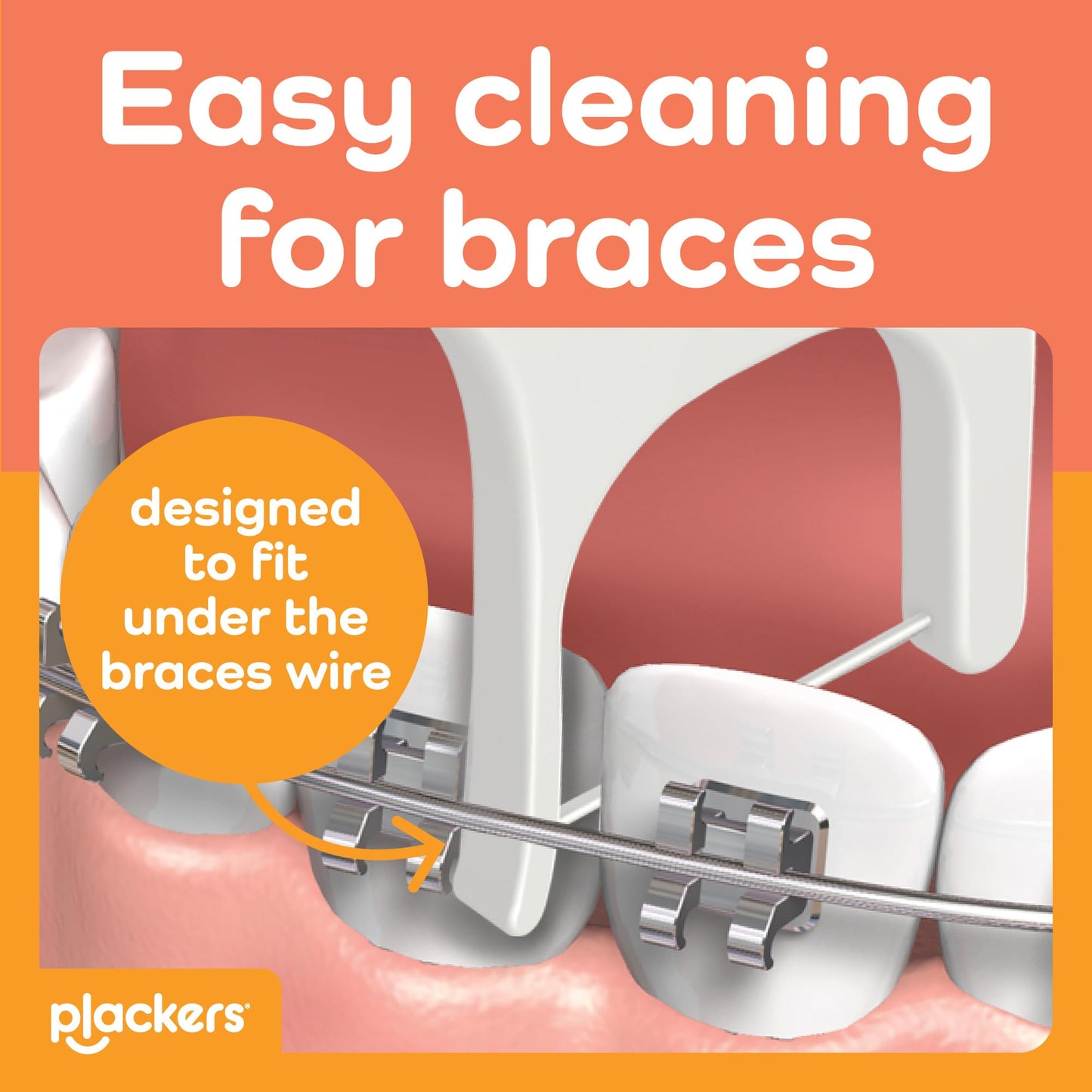 Plackers OrthoPick® Floss Picks Designed for Braces, Tuffloss® Made Without PTFE, FlipPick® Clean Between Brackets, 36 Count (4 Pack)