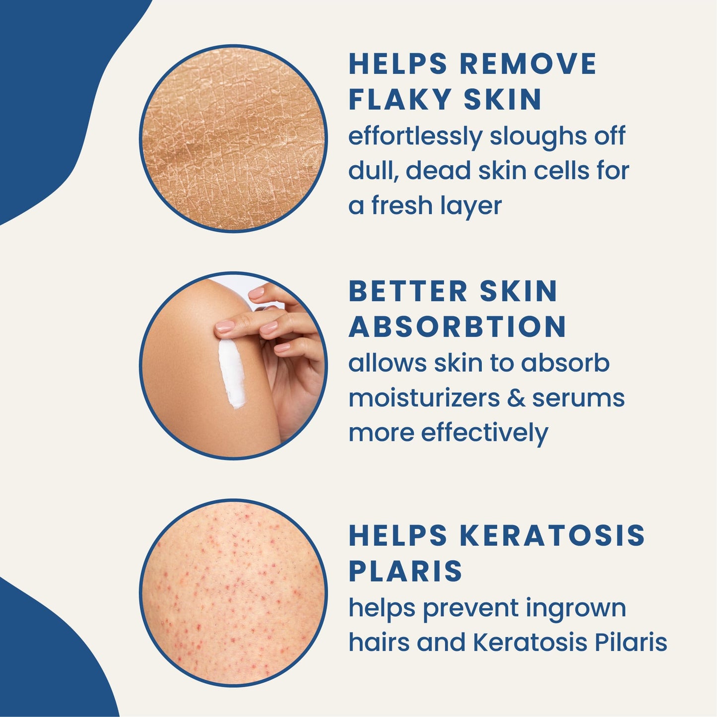 Moroccan Exfoliating Glove - Body Scrubber & Wash Mitt for Smoother Skin, Exfoliates Dead Skin Cells, Helps Even Skin Tone, Ideal for Self-Tan Removal & Keratosis Pilaris, Ingrown Hair