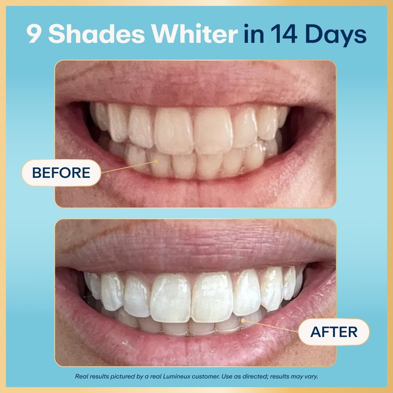 Lumineux Teeth Whitening Strips Kit - 9 Treatments (1 Month) - Peroxide Free - Enamel Safe for Whiter Teeth - Whitening Without The Sensitivity - Dentist Formulated - Sensitivity Free