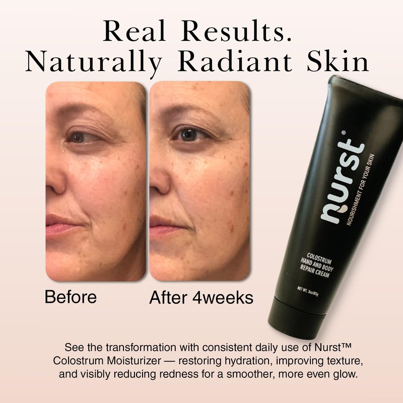 Nurst Colostrum Daily Face Moisturizer - Lightweight Hydrating Cream with Natural Citrus Scent - Daily Facial Moisturizer for All Skin Types - Niacinamide Hyaluronic Acid 0.5 Fl oz.