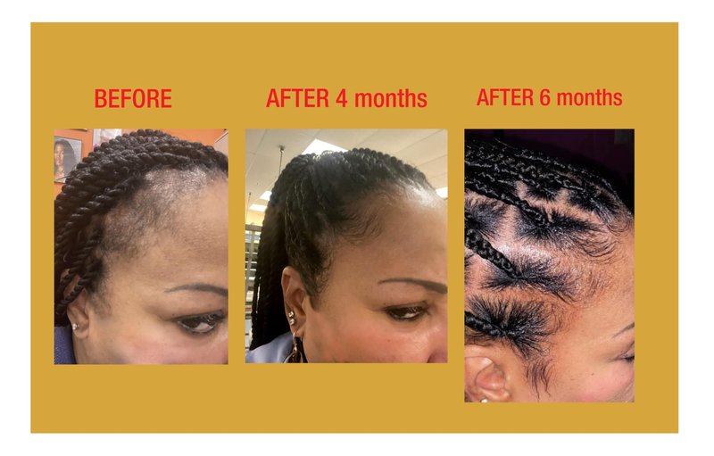 GOOD2GRO Biotin Growth & Thickening Shampoo - 8oz | Cleanse, Restore & Strengthen Hair | Reduce Hair Loss & Add Body & Shine | Vegan & Cruelty-Free