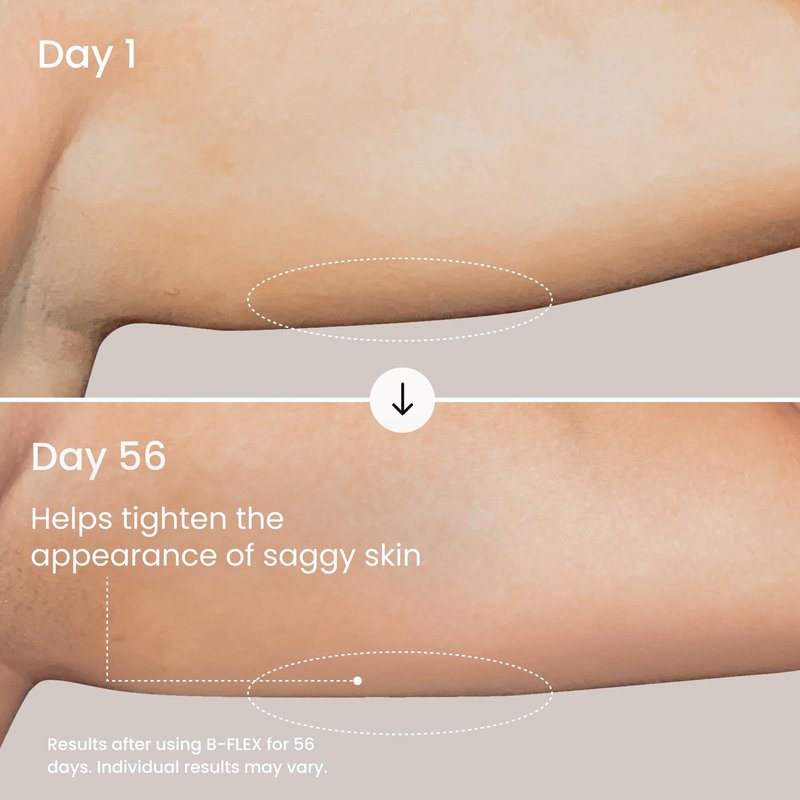 MAËLYS B-FLEX Arm Firming Cream - Skin Tightening Cream for Loose Skin & Crepey Skin - Helps Look of Aging and Sagging Skin - Arm Toning Cream - Red Algae & Kangaroo Flower (3.4 Fl Oz)