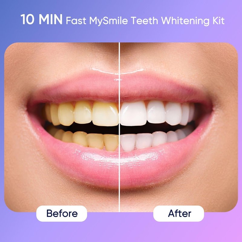 MySmile Teeth Whitening Kit - 10 Min LED Light Treatment with 35% Carbamide Peroxide | Removes Coffee, Soda, & Wine Stains
