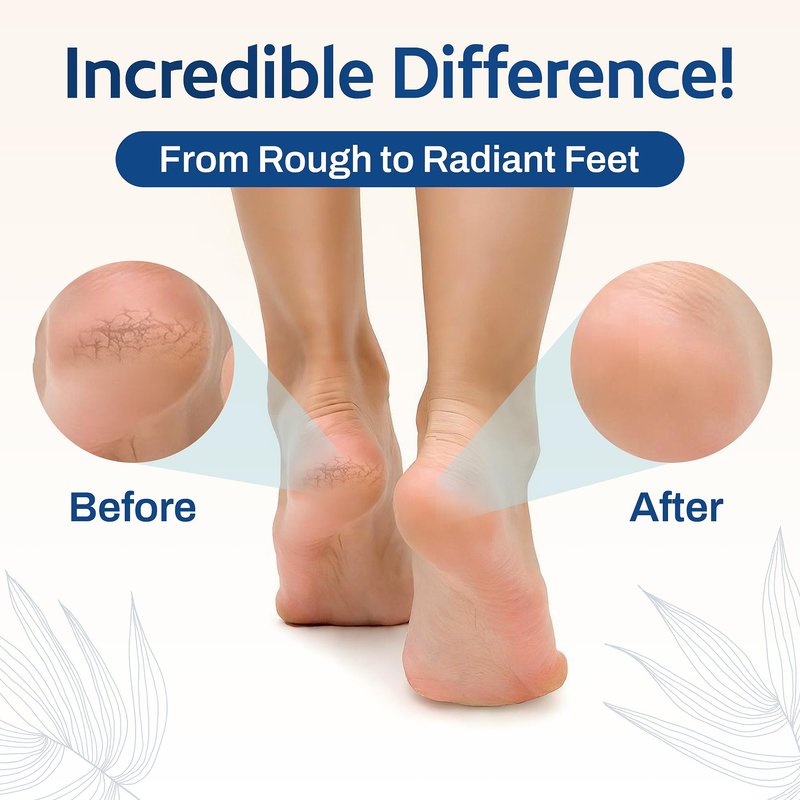 Hartfelt Magic Pumice Stone for Feet Callus Removal | Easy to Use Foot Scrubbing Stone for Removing Dead Skin from Heels, Toes, and Feet | Chemical-Free Foot Exfoliator - Pedicure Essential