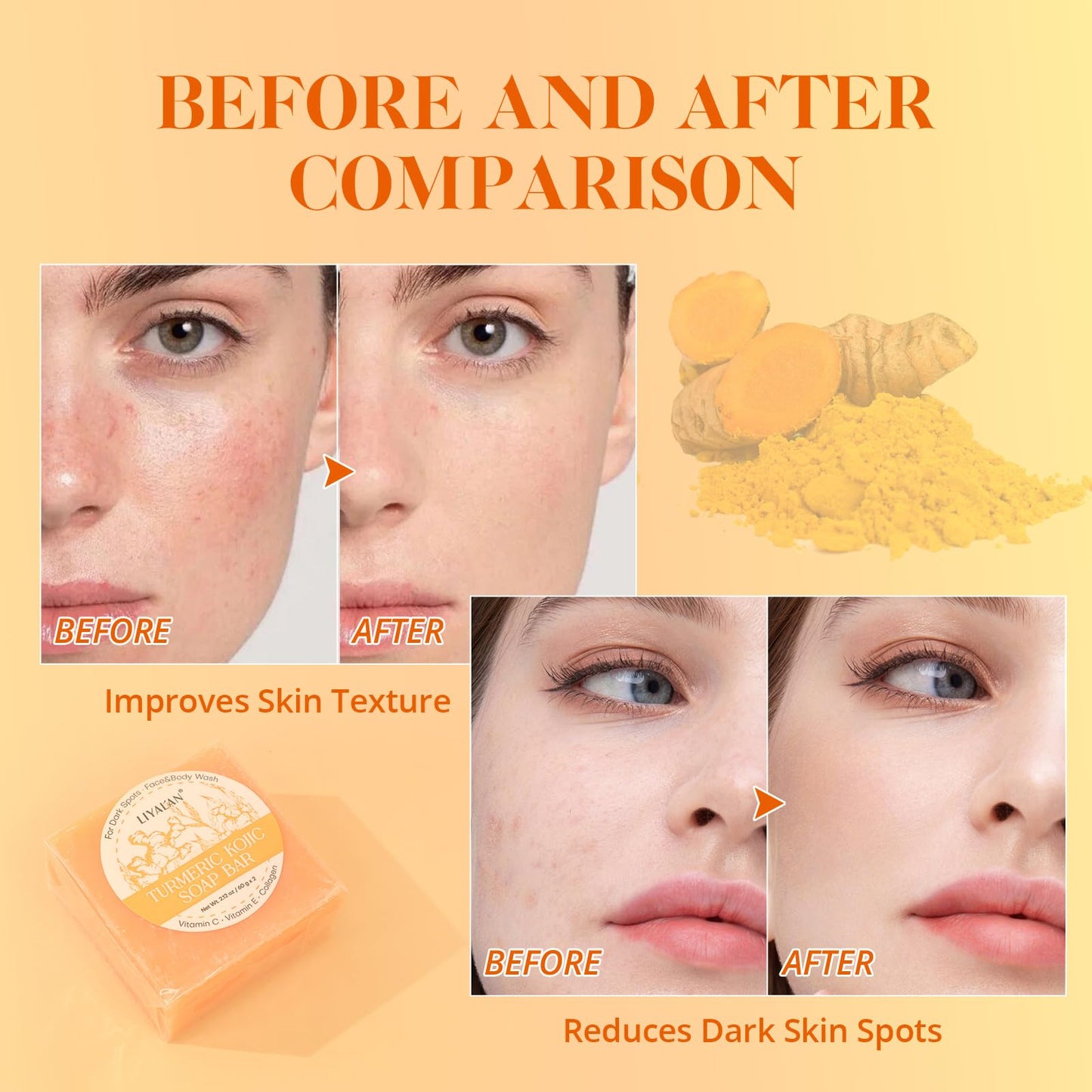 LIYALAN Turmeric Soap Bar