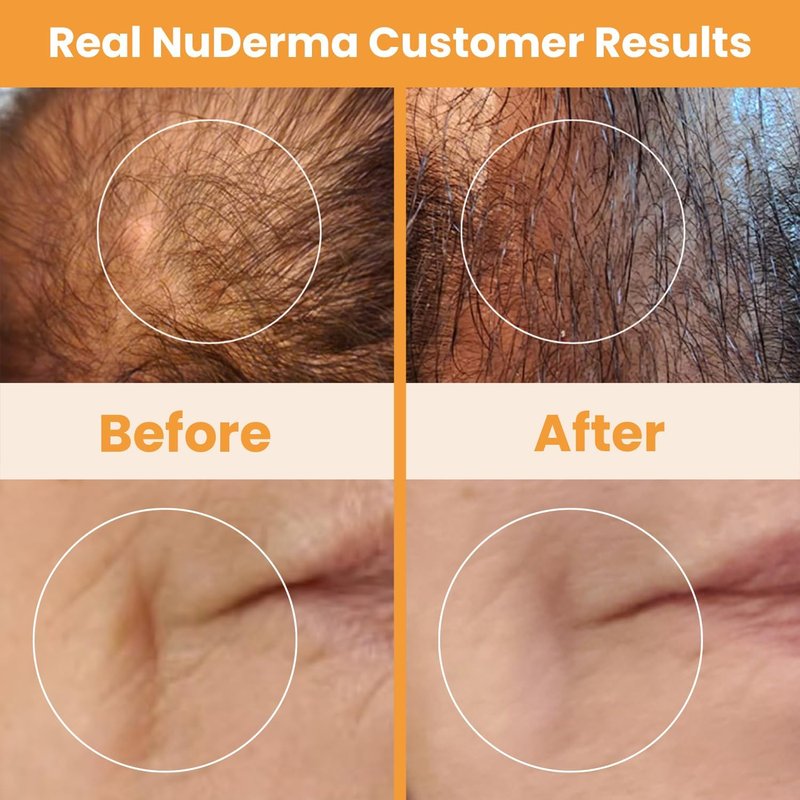 NuDerma Handheld Skin Therapy Wand - Anti-Aging, Skin Tightening & Wrinkle Reduction | Neon