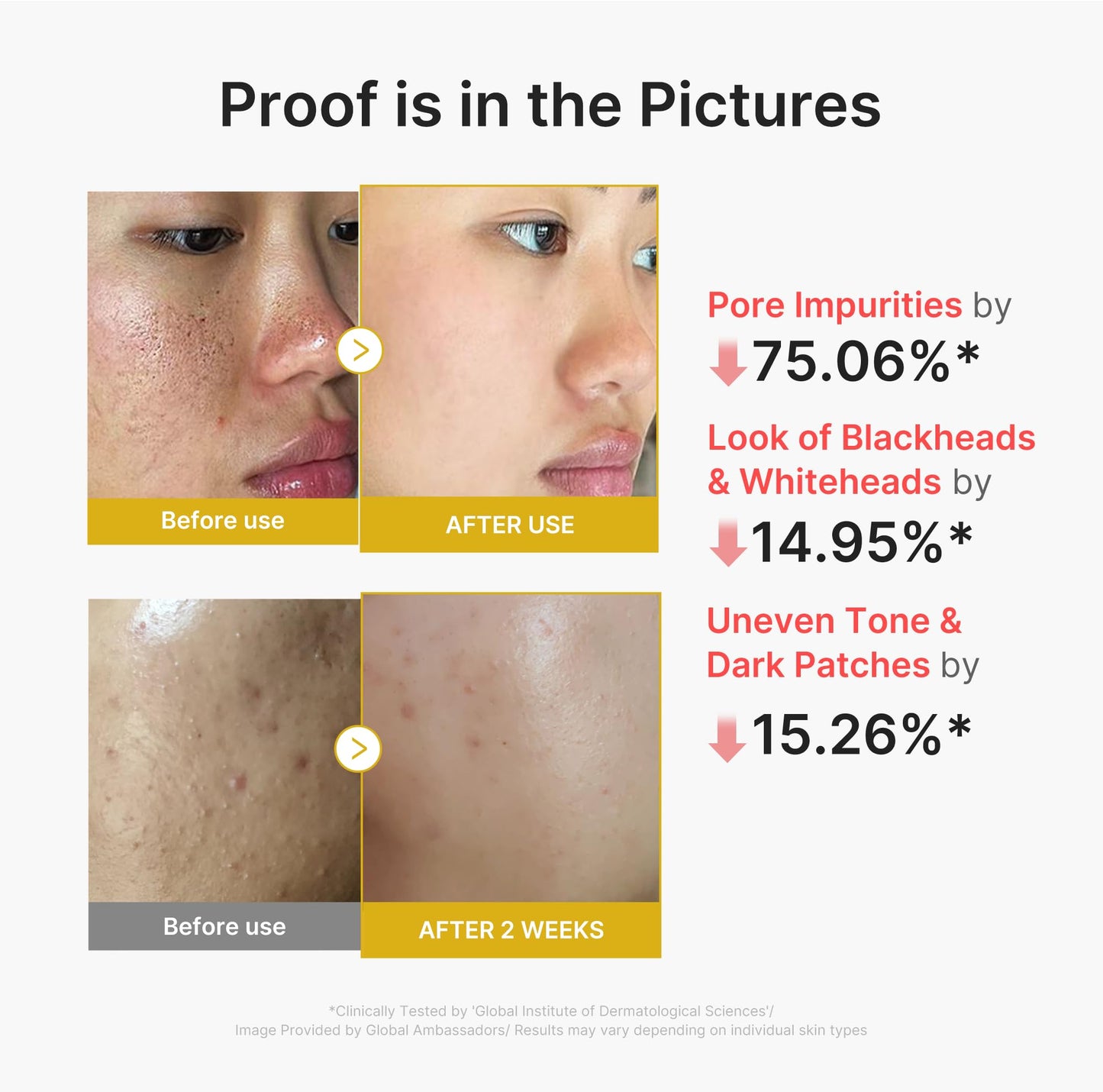 medicube Peel Shot with Kojic Acid Turmeric | Reset in One Step | Gentle Exfoliating Serum with BHA, LHA, PHA for Dead Skin Cells, Blackheads, Excess Sebum | For Dull, Rough, Troubled Skin | 2.7 fl.oz