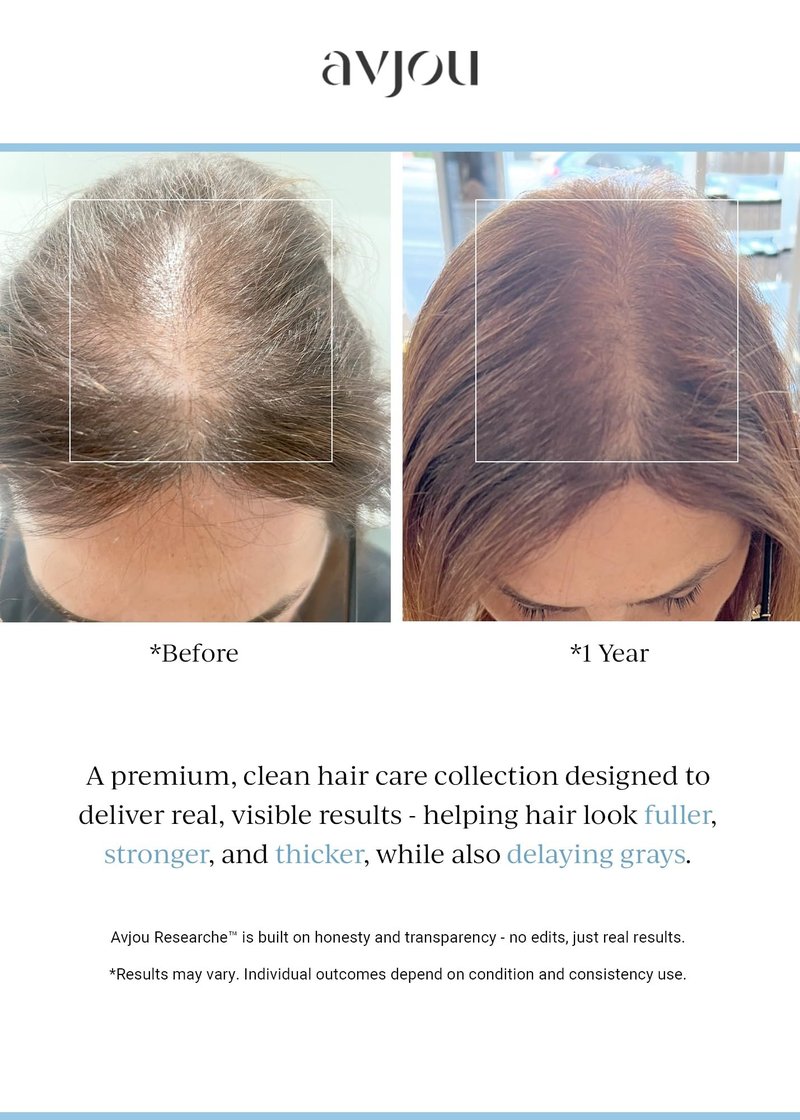 Avjou Researche™ Scalp Serum – Thicker, Fuller-Looking Hair + Targets Visible Signs of Premature Greying – 3 Patented Ingredients – Backed by Cosmetic Science – Oil-Free, All Hair Types, 1.7 oz