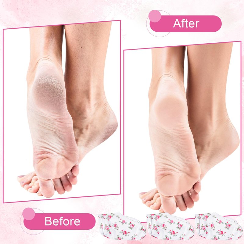 Cotwinter 12 Pairs Moisturizing Socks Overnight for Dry Feet Spa Lotion Sleeping Socks Cosmetic Moisturizing Dry Feet Healing Care for Cracked Skin Women Men