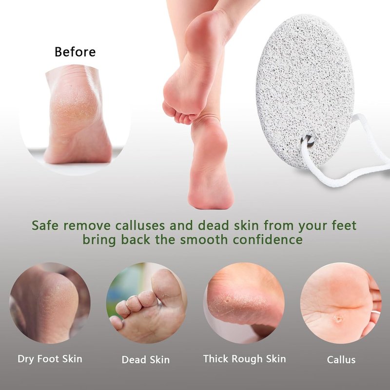 Natural Pumice Stone - 3-Pack Lava Pedicure Tools for Callus Removal | Exfoliating Foot File for Dead Skin on Heels & Elbows