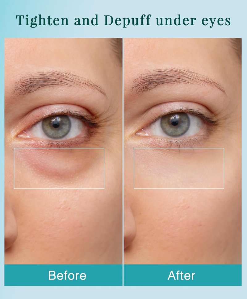 2 in 1 RF Microcurrent Eye Device - Professional Eye Care for Puffiness & Fine Lines | At-Home Anti-Aging Treatment