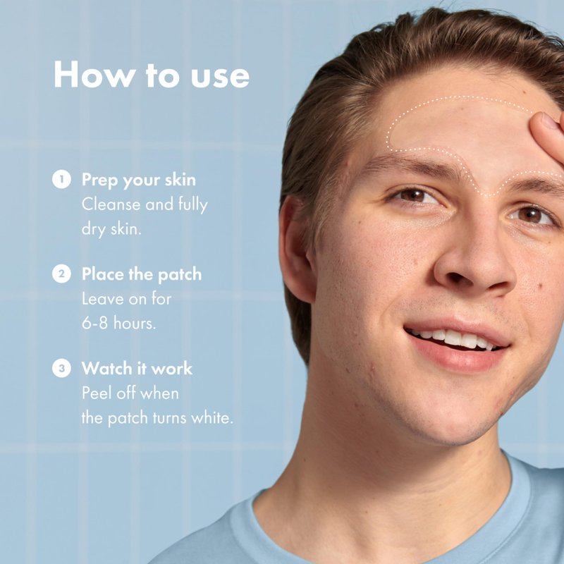 Hero Cosmetics Mighty Patch™ Forehead Patch - Hydrocolloid Acne Pimple Patch, Contoured to Cover Larger Area of Zits and Blemishes - Drug-Free and Suitable for Sensitive Skin (5 Count)