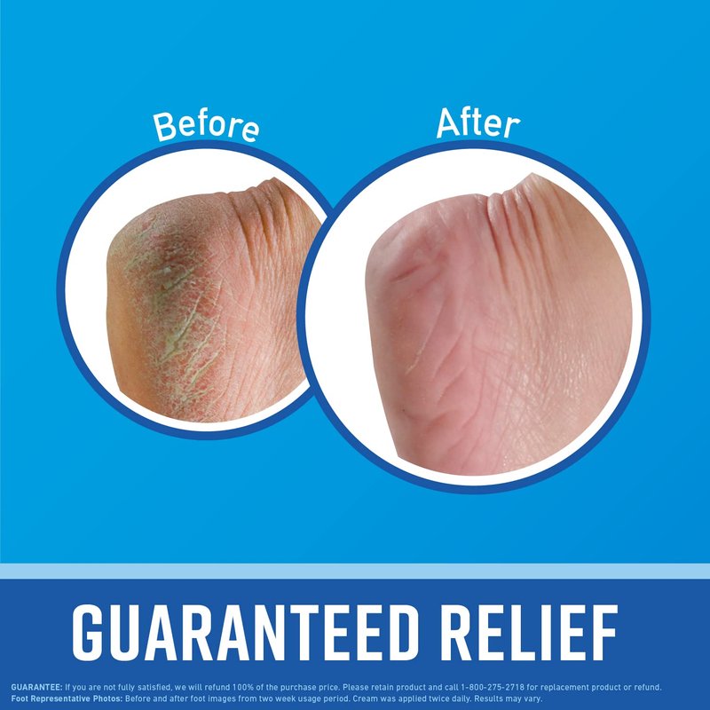 O'Keeffe's for Healthy Feet Foot Cream; Guaranteed Relief for Extremely Dry; Cracked Feet; Instantly Boosts Moisture Levels; 3.2 Ounce Jar; (Pack of 6)