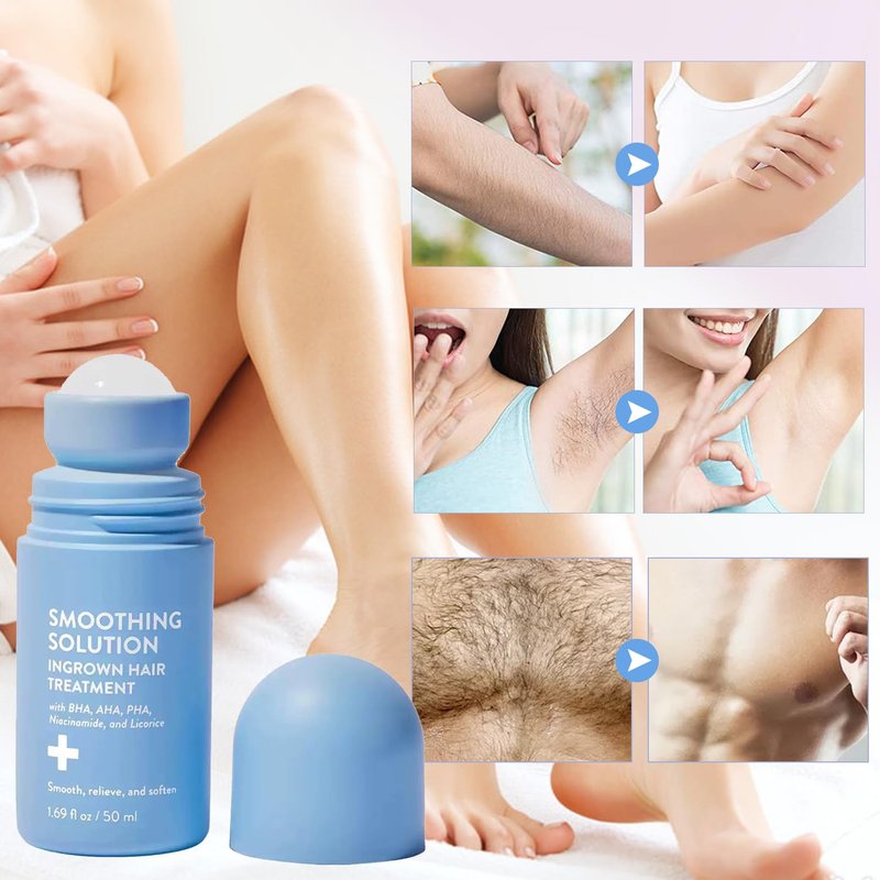Ingrown Hair Treatment Serum - Smoothing Solution for Razor Bumps & Bikini Line | Soothing Aftercare for Soft Skin