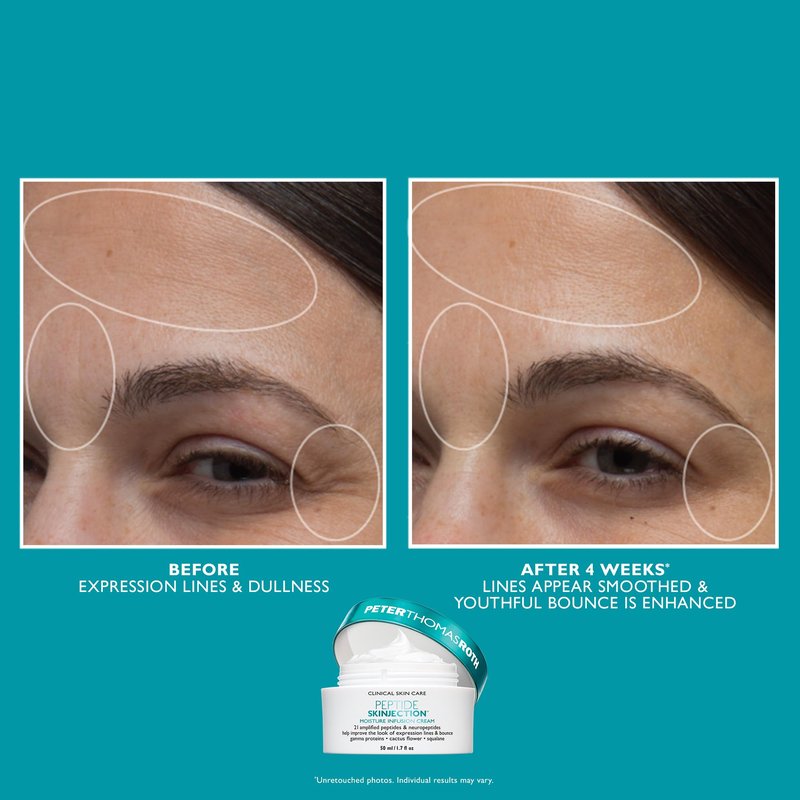 Peter Thomas Roth | Full-Size Peptide Skinjection™ Solutions 2-Piece Face & Eye Kit | Anti-Aging Peptide Skincare Set, Under-Eye Cream and Moisturizer